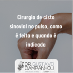Cirurgia de cisto sinovial no pulso, como é feita e quando é indicada