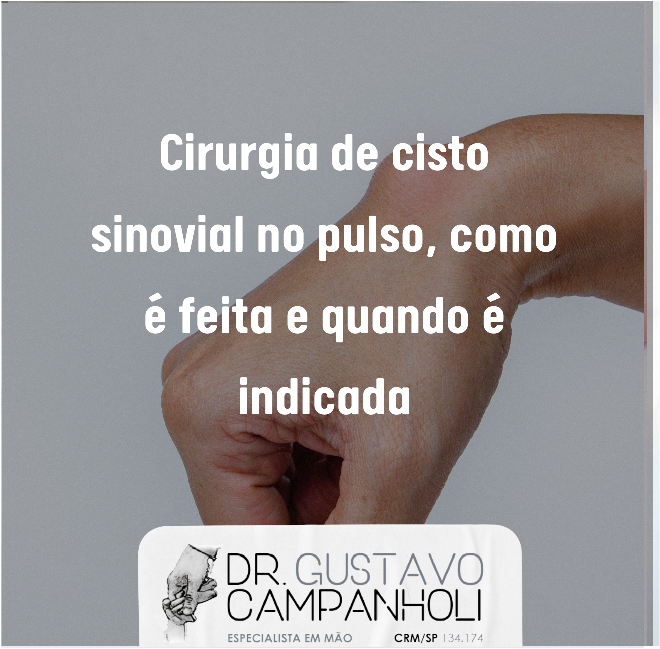 Cirurgia de cisto sinovial no pulso, como é feita e quando é indicada